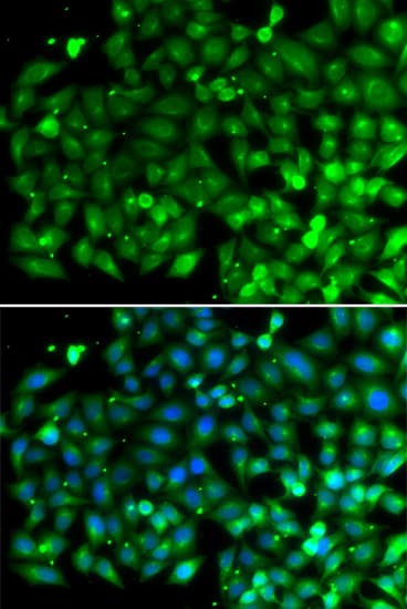SH3GLB1 / Bif / Endophilin B1 Antibody