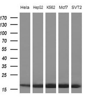 EIF1AY Antibody (aa2-144, clone OTI2G2)