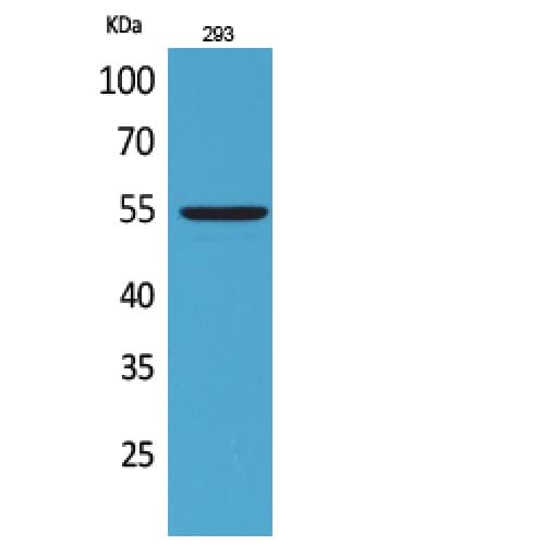 GDF5 / GDF-5 Antibody (351-400 aa, Internal)
