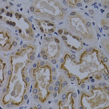 IHC-plus™ Polyclonal Rabbit anti-Human TNFRSF6B / DCR3 Antibody (IHC, WB)