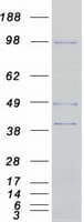 Human ARHGEF15 Protein (Recombinant Myc-DDK (Flag))