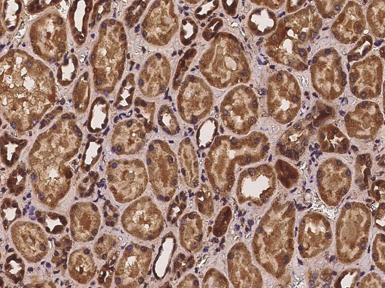 Polyclonal Rabbit anti-Human PSMG3 Antibody (IHC)
