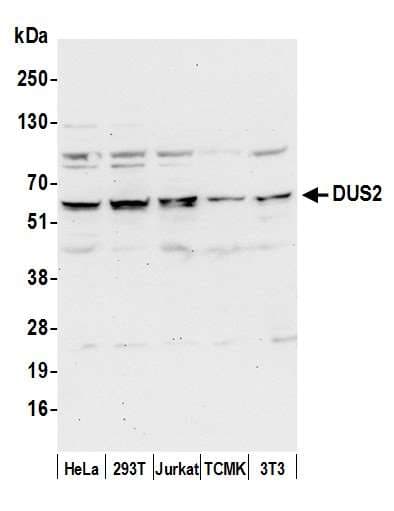 DUS2 / DUS2L Antibody (aa443-493)