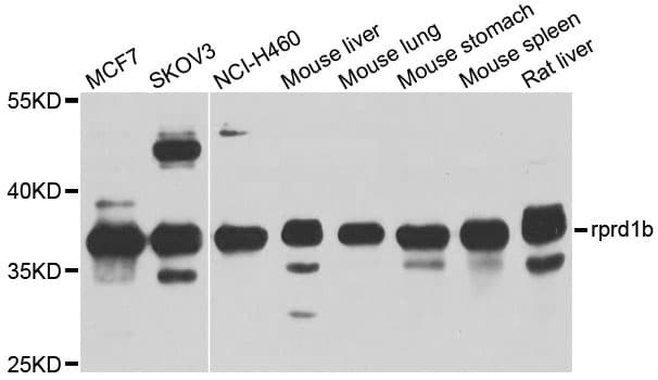 RPRD1B Antibody
