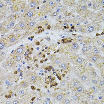 BEST1 / BEST / Bestrophin Antibody