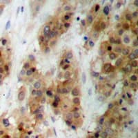 CMPK / CMPK1 Antibody (N-Terminus)