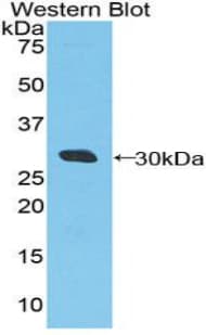 DDX58 / RIG-1 / RIG-I Antibody (aa550-776, Biotin)