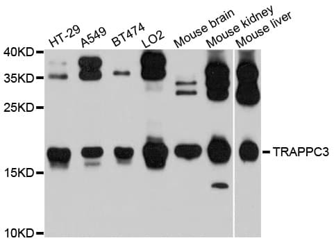 TRAPPC3 Antibody (AP)