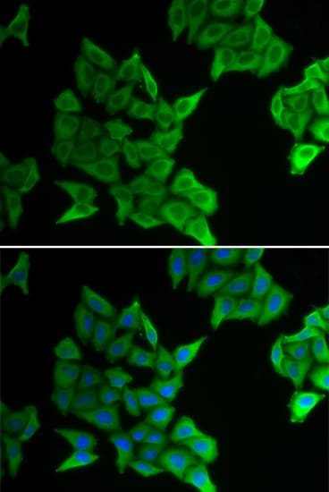 GJA5 / CX40 / Connexin 40 Antibody