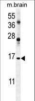 Polyclonal Rabbit anti-Human ENSA Antibody (aa39-66, WB)