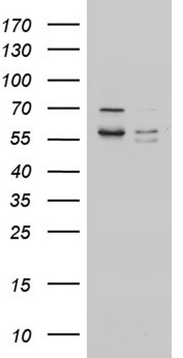 MTDH / Metadherin Antibody (aa70-582, clone OTI4C5)