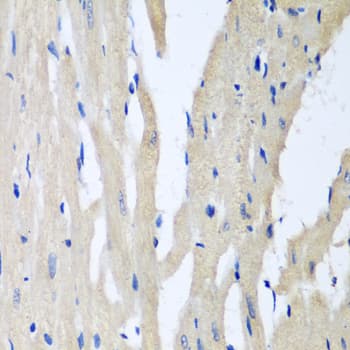 PITRM1 / MP1 Antibody