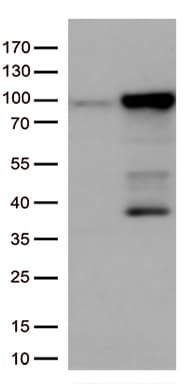EWSR1 / EWS Antibody (aa256-447, clone OTI2G3)