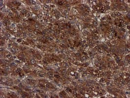 Complement C1s Antibody (clone OTI4E3)