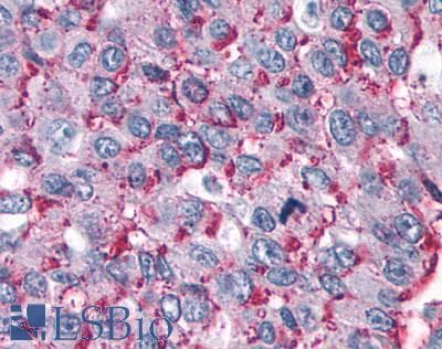 PathPlus™ Polyclonal Rabbit anti-Human RORC / ROR Gamma Antibody (Ligand-binding Domain, IHC)