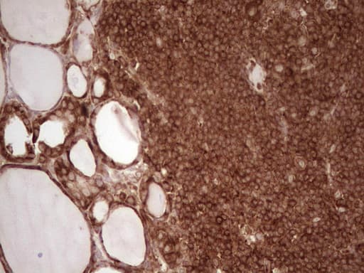 Monoclonal Mouse anti-Human WIBG Antibody (clone OTI5E2, IHC, WB)
