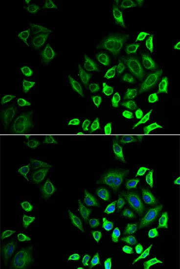 IHC-plus™ PLA2G2D Antibody