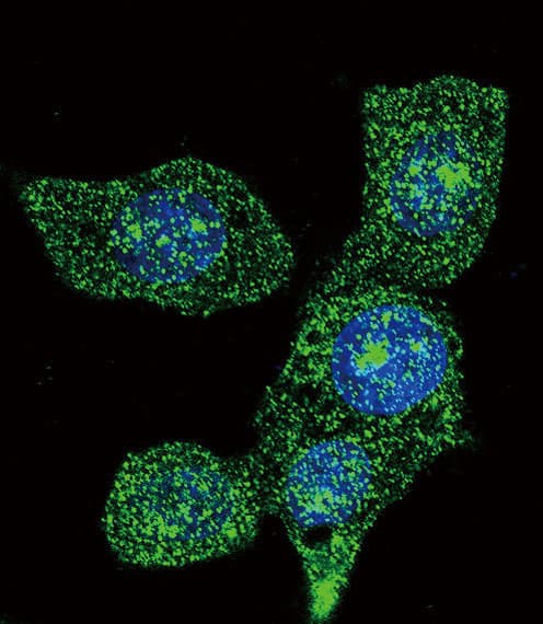 IHC-plus™ ACOX1 / ACOX Antibody