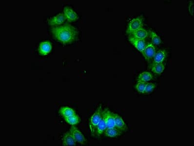 LACTB2 Antibody