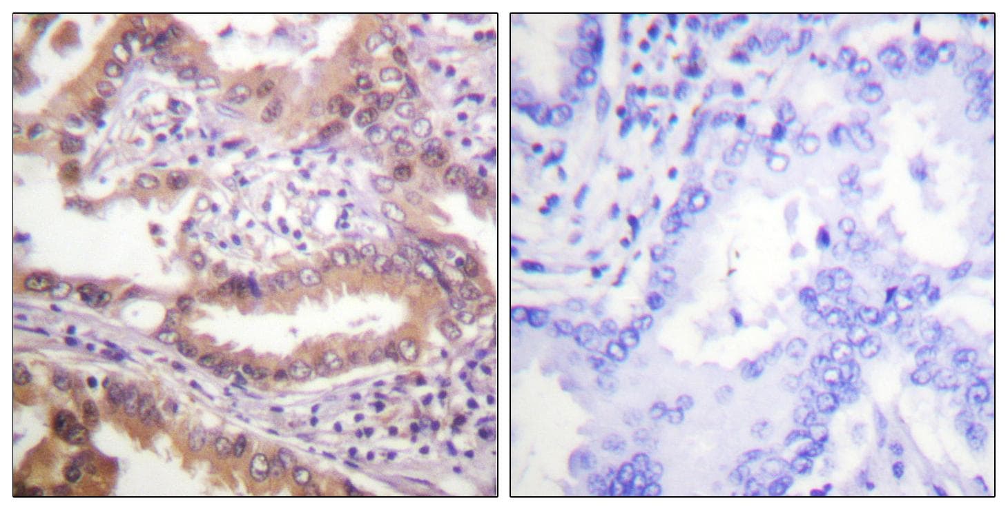 Polyclonal Rabbit anti-Human IRF3 Antibody (p385, IHC, IF, WB)