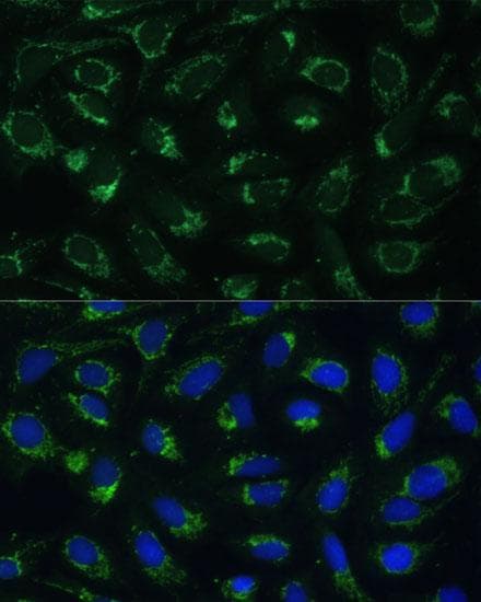 ETFB Antibody