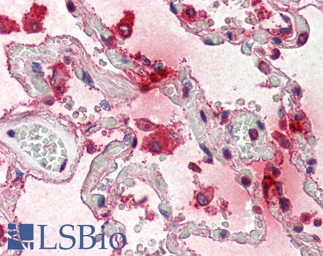 IHC-plus™ Monoclonal Mouse anti-Human TPSAB1 / Mast Cell Tryptase Antibody (clone AA1, IHC, WB)