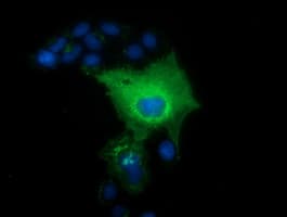 Monoclonal Mouse anti-Human L1CAM Antibody (clone OTI1D12, IF, WB)