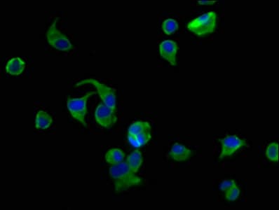 AVPR2 / V2R Antibody