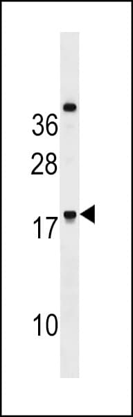 Polyclonal Rabbit anti-Human RNF224 Antibody (aa79-105, WB)