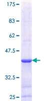 Human DGAT2 Protein (Recombinant GST, N-terminus)