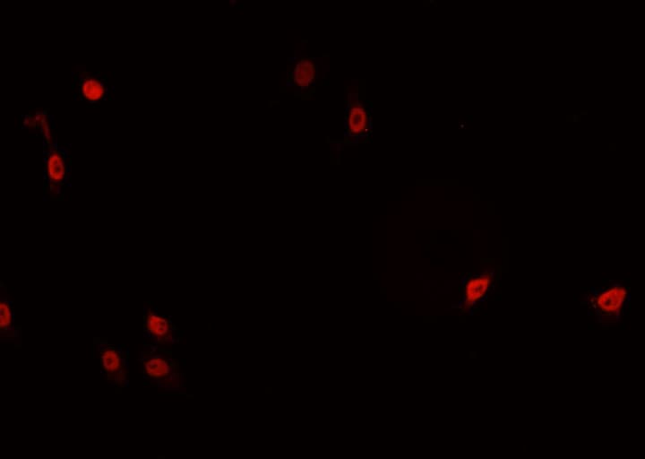 TNFAIP8 / SCC-S2 Antibody