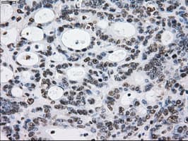 Monoclonal Mouse anti-Human L1CAM Antibody (clone OTI4F4, IHC, IF, WB)