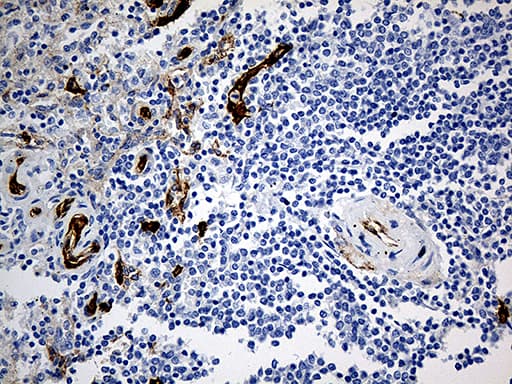Monoclonal Mouse anti-Human CD34 Antibody (clone OTI8F11, aa312-385, IHC, WB)