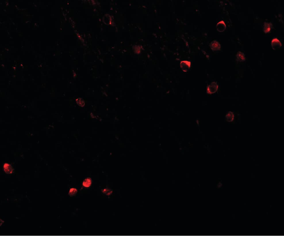 SPRYD3 Antibody
