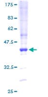 Human MEF2BNB Protein (Recombinant GST)