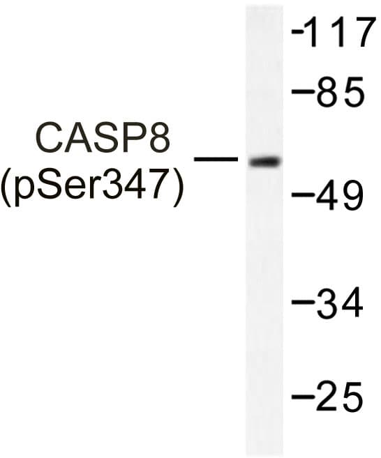 Polyclonal Rabbit anti-Human CASP8 / Caspase 8 Antibody (Thr341, IHC, WB)