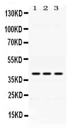Polyclonal Rabbit anti-Human ADH1A / Alcohol Dehydrogenase Antibody (IHC, WB)