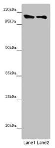 DDX11 / CHLR1 Antibody