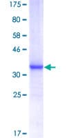 Human MAGEA4 Protein (Recombinant GST, N-terminus)