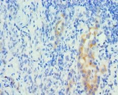 Polyclonal Rabbit anti-Human PIAS1 Antibody (aa422-651, IHC)