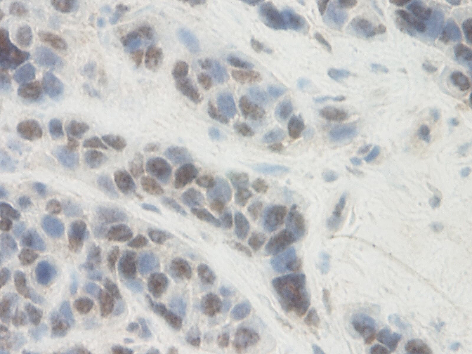 SERPINE1 / PAI-1 Antibody