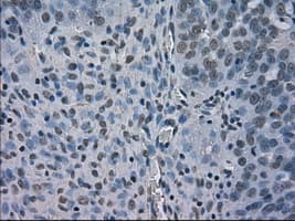 BUB1B / BubR1 Antibody (clone OTI11D7, Carrier-free)