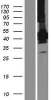 LFNG / Lunatic Fringe Protein (Over-Expression Lysate Myc-DDK (Flag))