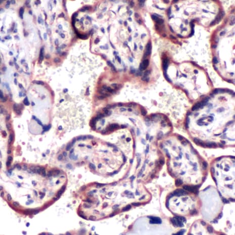 Polyclonal Rabbit anti-Human SOCS6 / SOCS-6 Antibody (C-Terminus, IHC, WB)
