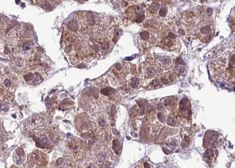 MAP2K1 / MKK1 / MEK1 Antibody (phospho-Ser217)