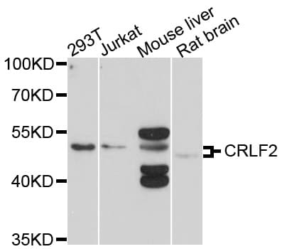 Polyclonal Rabbit anti-Human CRLF2 / TSLPR Antibody (WB)