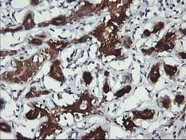 Monoclonal Mouse anti-Human BBOX1 / BBOX Antibody (clone OTI8B12, IHC, WB)