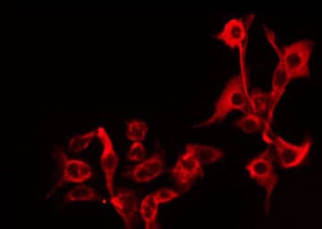 Polyclonal Rabbit anti-Human B4GALT5 Antibody (IF, WB)