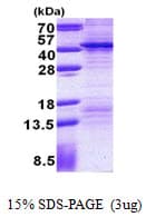 Human FSBP Protein (Recombinant His)