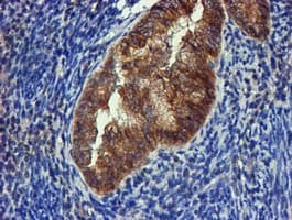 FGFR2 / FGF Receptor 2 Antibody (clone OTI3F8)